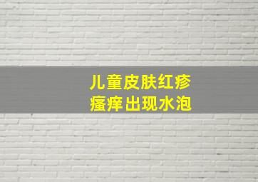 儿童皮肤红疹 瘙痒出现水泡